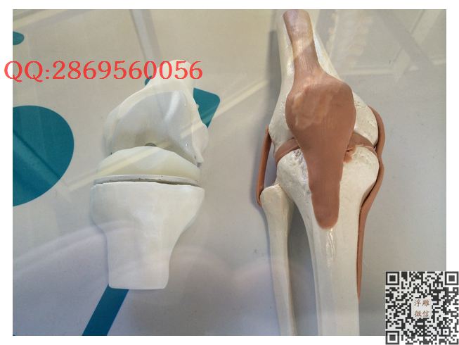 膝关节假体_STL圆雕图立体模型3d打印核雕精雕图浮雕图